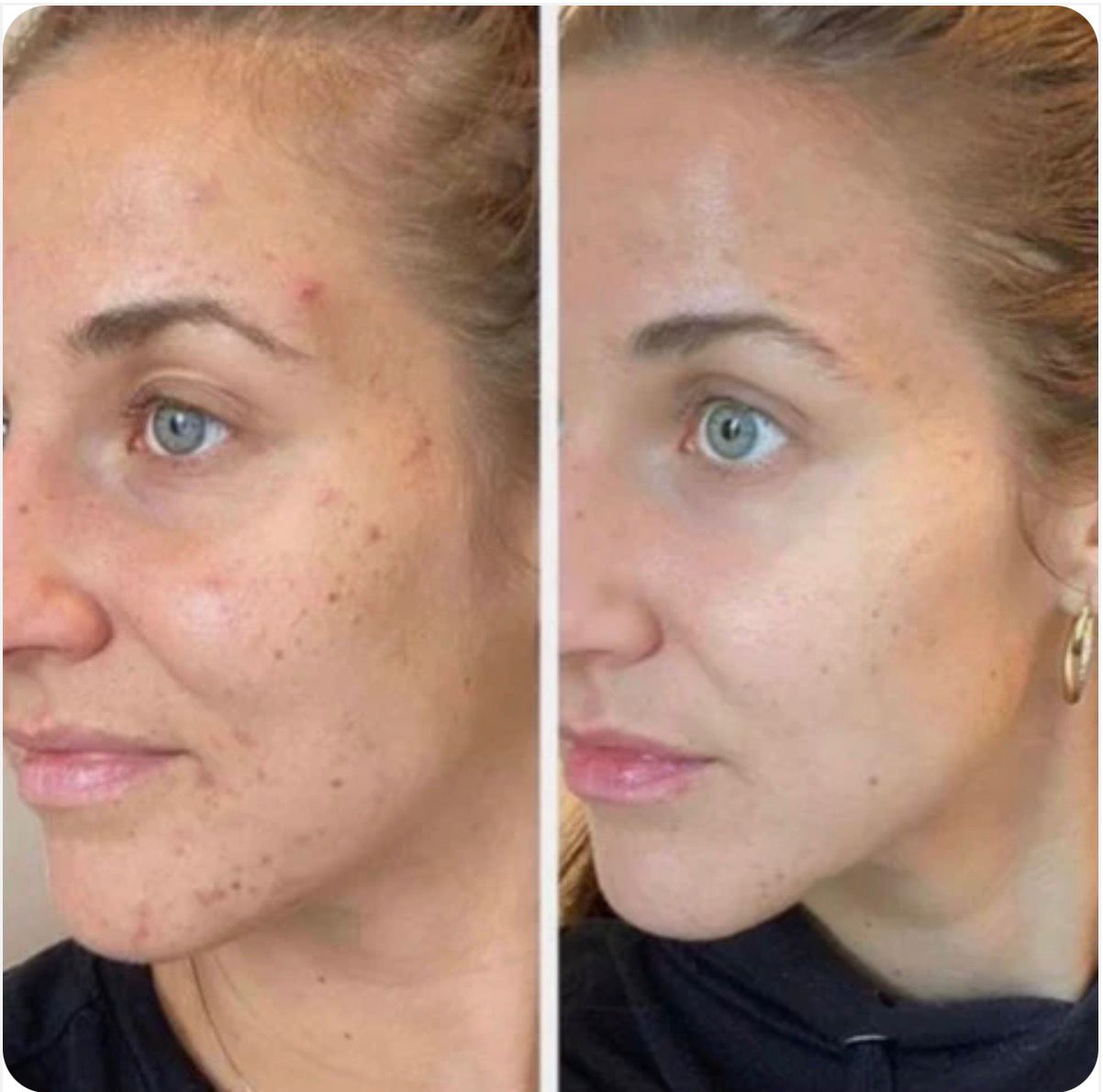 Solução Antirrugas com Extrato de Geleia Real